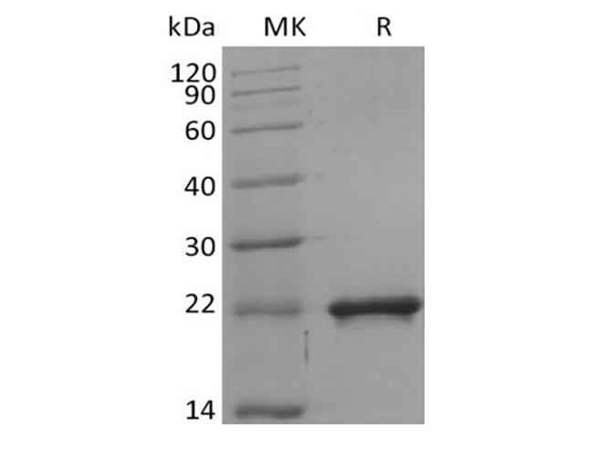 SHH / Sonic Hedgehog Protein - Recombinant Mouse Sonic Hedgehog/SHH (C-6His)