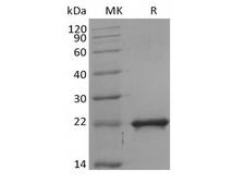 SHH / Sonic Hedgehog Protein - Recombinant Mouse Sonic Hedgehog/SHH (C-6His)
