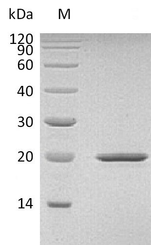 SHH / Sonic Hedgehog Protein - (Tris-Glycine gel) Discontinuous SDS-PAGE (reduced) with 5% enrichment gel and 15% separation gel.