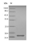 SIGIRR Protein - (Tris-Glycine gel) Discontinuous SDS-PAGE (reduced) with 5% enrichment gel and 15% separation gel.