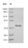 SIGIRR Protein - (Tris-Glycine gel) Discontinuous SDS-PAGE (reduced) with 5% enrichment gel and 15% separation gel.