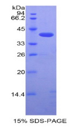 SIGIRR Protein - Recombinant Single Ig IL1 Related Receptor By SDS-PAGE