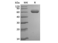 SIGLEC8 Protein - Recombinant Mouse Siglec-F (C-6His)