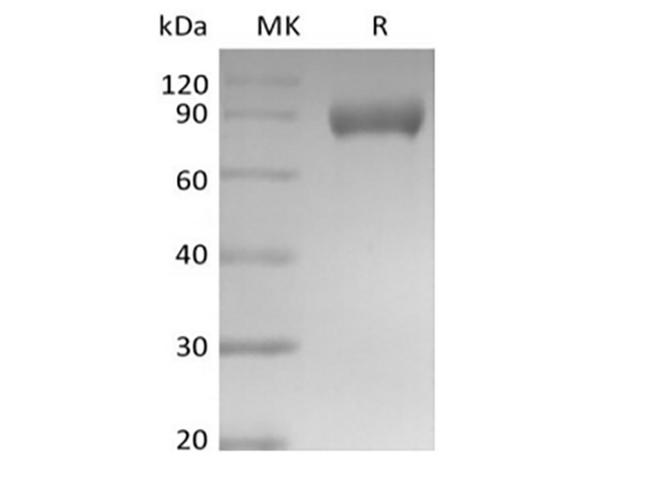 Siglece Protein - Recombinant Mouse Siglec-E (C-Fc)