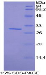 SIK2 / SNF1LK2 Protein - Recombinant Salt Inducible Kinase 2 By SDS-PAGE