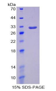 SIRPA / CD172a Protein - Recombinant Signal Regulatory Protein Alpha By SDS-PAGE