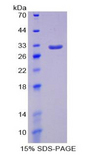 SIRPA / CD172a Protein - Recombinant Signal Regulatory Protein Alpha By SDS-PAGE