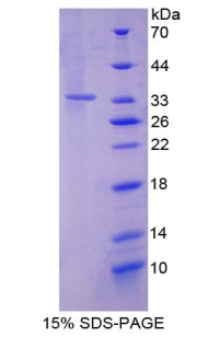 SIRT2 / Sirtuin 2 Protein - Recombinant Sirtuin 2 By SDS-PAGE