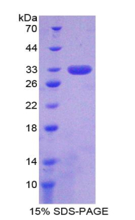 SIRT3 / Sirtuin 3 Protein