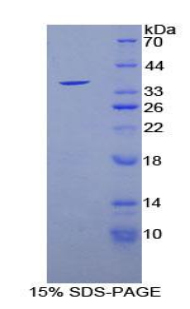SIRT6 / Sirtuin 6 Protein - Recombinant Sirtuin 6 By SDS-PAGE