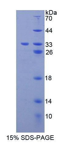SLC20A1 Protein - Recombinant Gibbon Ape Leukemia Virus Receptor 1 (GLVR1) by SDS-PAGE