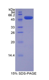 SLC27A5 / BACS Protein - Recombinant Fatty Acid Transport Protein 5 By SDS-PAGE