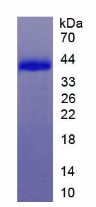 SLC7A11 / XCT Protein - Recombinant Solute Carrier Family 7, Member 11 (SLC7A11) by SDS-PAGE