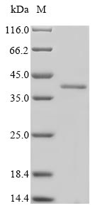 SMN1 Protein - (Tris-Glycine gel) Discontinuous SDS-PAGE (reduced) with 5% enrichment gel and 15% separation gel.