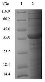 SMN1 Protein - (Tris-Glycine gel) Discontinuous SDS-PAGE (reduced) with 5% enrichment gel and 15% separation gel.