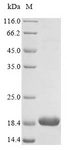 SNCB / Beta-Synuclein Protein - (Tris-Glycine gel) Discontinuous SDS-PAGE (reduced) with 5% enrichment gel and 15% separation gel.