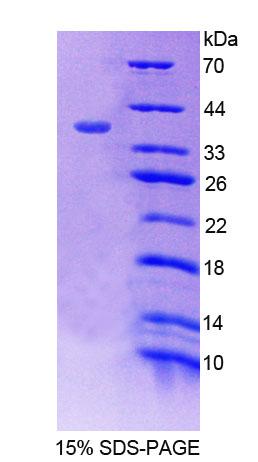 SNTB1 / A1B Protein - Recombinant  Syntrophin Beta 1 By SDS-PAGE