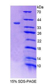 SNTB1 / A1B Protein - Recombinant  Syntrophin Beta 1 By SDS-PAGE