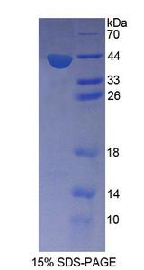 SNUPN Protein - Recombinant  Snurportin 1 By SDS-PAGE