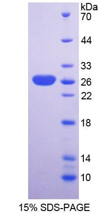SNX18 Protein - Recombinant  Sorting Nexin Associated Golgi Protein 1 By SDS-PAGE