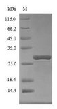 SOCS1 Protein - (Tris-Glycine gel) Discontinuous SDS-PAGE (reduced) with 5% enrichment gel and 15% separation gel.