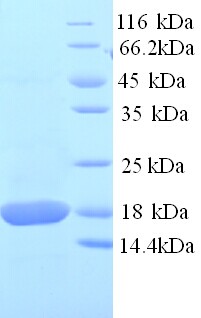 SOD1 / Cu-Zn SOD Protein