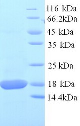 SOD1 / Cu-Zn SOD Protein
