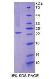 SOD2 / Mn SOD Protein - Recombinant Superoxide Dismutase 2, Mitochondrial By SDS-PAGE