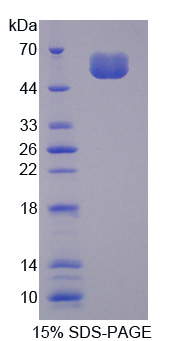 SOST / Sclerostin Protein - Recombinant Sclerostin By SDS-PAGE