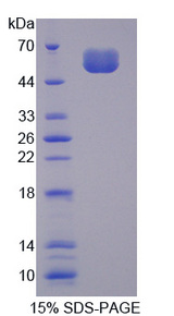 SOST / Sclerostin Protein - Recombinant Sclerostin By SDS-PAGE