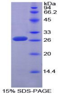 SP100 Protein - Recombinant Sp100 Nuclear Antigen By SDS-PAGE