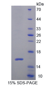 SPECC1 / CYTSB Protein - Recombinant  Cytospin B By SDS-PAGE