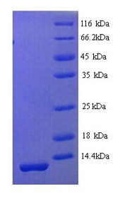 SPINK1 Protein