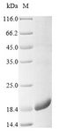 SPINK2 Protein - (Tris-Glycine gel) Discontinuous SDS-PAGE (reduced) with 5% enrichment gel and 15% separation gel.