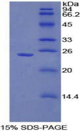 SPRY1 / Sprouty 1 Protein - Recombinant Sprouty Homolog 1 By SDS-PAGE