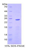 SPRY2 / Sprouty 2 Protein - Recombinant Sprouty Homolog 2 By SDS-PAGE