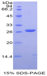 SPTAN1 / Alpha Fodrin Protein - Recombinant Alpha-Fodrin By SDS-PAGE