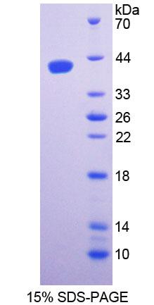 SPTLC1 / HSN1 Protein - Recombinant  Serine Palmitoyltransferase, Long Chain Base Subunit 1 By SDS-PAGE