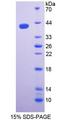 SPTLC1 / HSN1 Protein - Recombinant  Serine Palmitoyltransferase, Long Chain Base Subunit 1 By SDS-PAGE