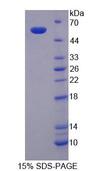 SPTLC3 / C20orf38 Protein - Recombinant Serine Palmitoyltransferase, Long Chain Base Subunit 3 By SDS-PAGE