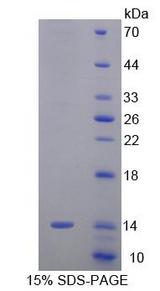 SRP9 Protein - Recombinant Signal Recognition Particle 9kDa By SDS-PAGE