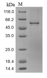 SRPX2 Protein - (Tris-Glycine gel) Discontinuous SDS-PAGE (reduced) with 5% enrichment gel and 15% separation gel.