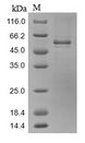 SRPX2 Protein - (Tris-Glycine gel) Discontinuous SDS-PAGE (reduced) with 5% enrichment gel and 15% separation gel.