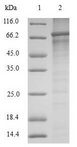 SRPX2 Protein - (Tris-Glycine gel) Discontinuous SDS-PAGE (reduced) with 5% enrichment gel and 15% separation gel.