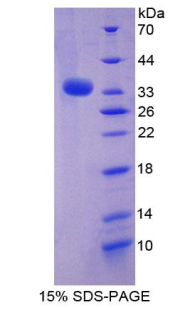 STAM1 / STAM Protein - Recombinant Signal Transducing Adaptor Molecule 1 By SDS-PAGE