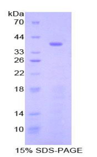 STAP1 / BRDG1 Protein - Recombinant Signal Transducing Adaptor Protein 1 By SDS-PAGE