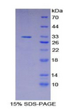 STAT2 Protein - Recombinant Signal Transducer And Activator Of Transcription 2 By SDS-PAGE