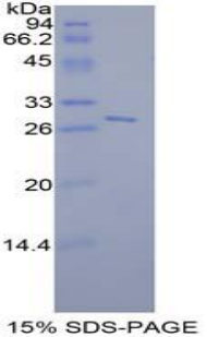 STAT6 Protein - Recombinant Signal Transducer And Activator Of Transcription 6 By SDS-PAGE