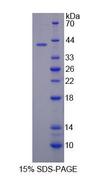 SULF2 / Sulfatase 2 Protein - Recombinant Sulfatase 2 By SDS-PAGE