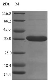 SUSD4 Protein - (Tris-Glycine gel) Discontinuous SDS-PAGE (reduced) with 5% enrichment gel and 15% separation gel.